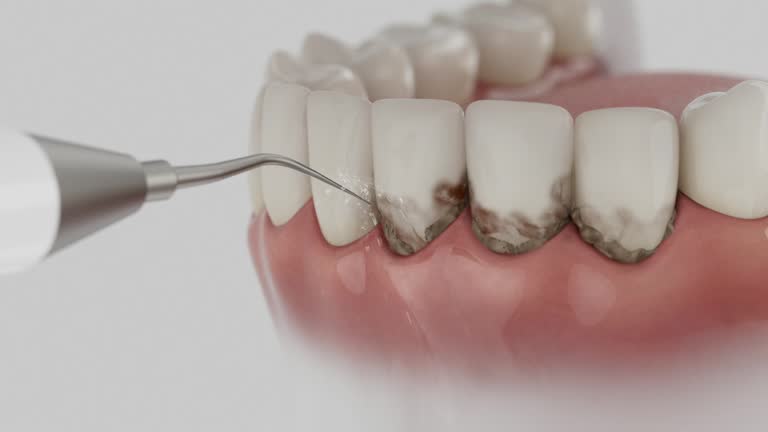 Trusted Dental Implants service in Pine Lakes, FL - Dentist Open Now